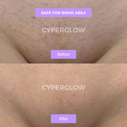 CyperGlow™ - Cyperus Rotundus Skin Serum